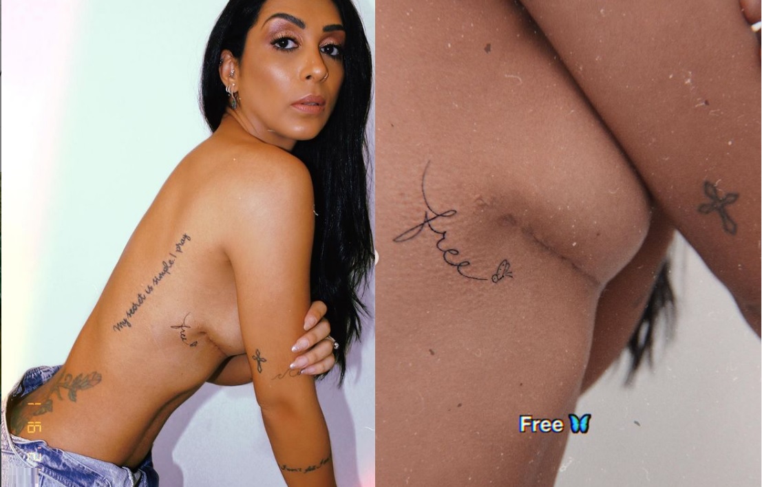 Ex-BBB Amanda mostra cicatriz e comemora retirada do silicone: ‘livre'