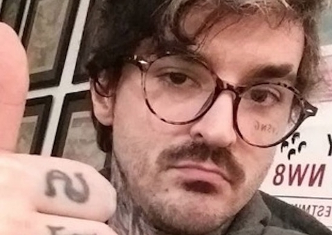 PC Siqueira revela que está com doença degenerativa rara: 'necrosado'