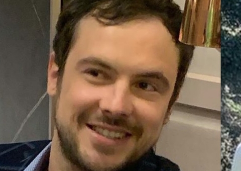 Sérgio Guizé mostra resultado de transplante capilar 