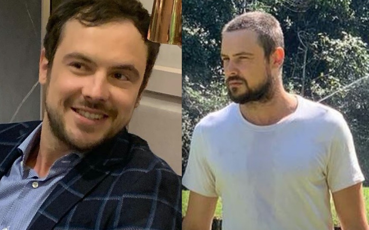 Sérgio Guizé mostra resultado de transplante capilar 