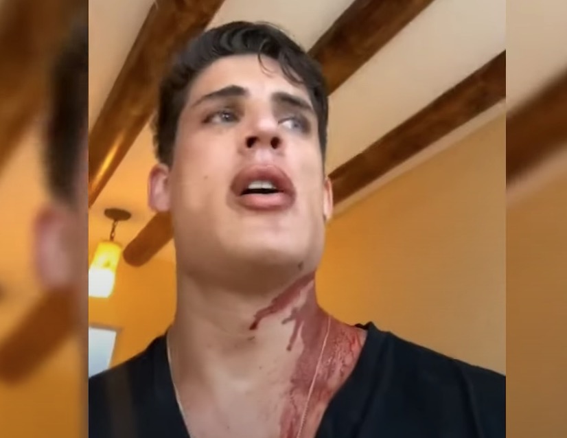 Tiago Ramos diz que foi esfaqueado em Cancún após viajar com Nadine