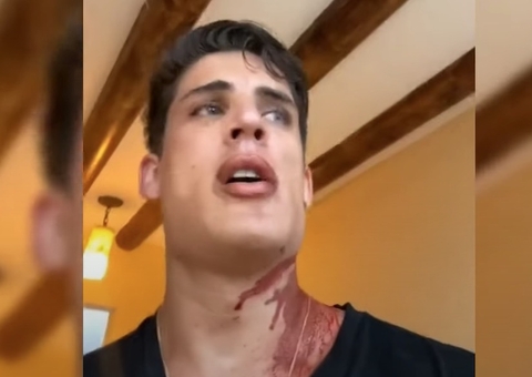 Tiago Ramos diz que foi esfaqueado em Cancún após viajar com Nadine