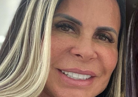 Gretchen e marido fazem harmonização facial; veja o resultado