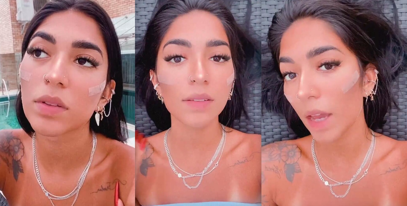 Aos 19 anos, irmã de Gabigol faz segunda harmonização facial