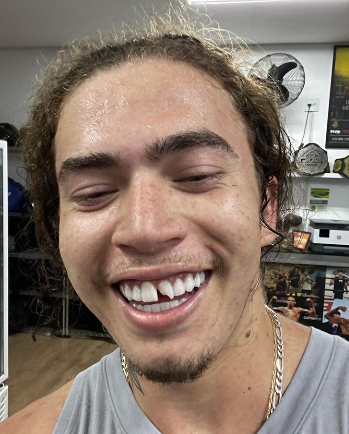 Whindersson Nunes quebra dente durante treino de boxe; veja momento