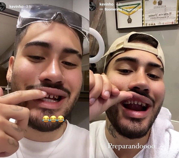 Kevinho surge sem lentes de contato nos dentes e deixa fãs horrorizados 