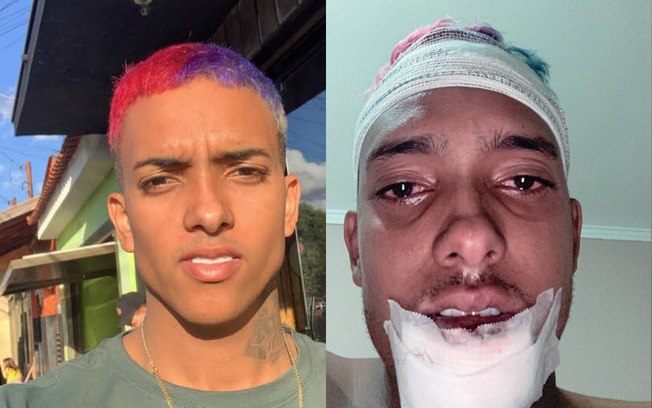 MC Brinquedo sofre acidente e desabafa: 'Deus me deixou viver'
