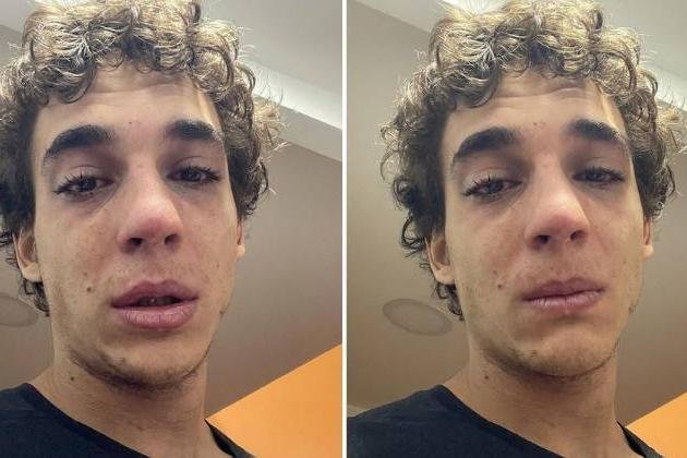 Astro de La Casa de Papel afirma estar destruído após Covid