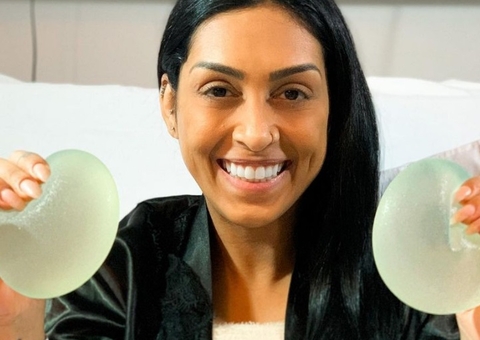 Ex-BBB Amanda retira silicone após 14 anos e comemora: ‘bomba relógio'