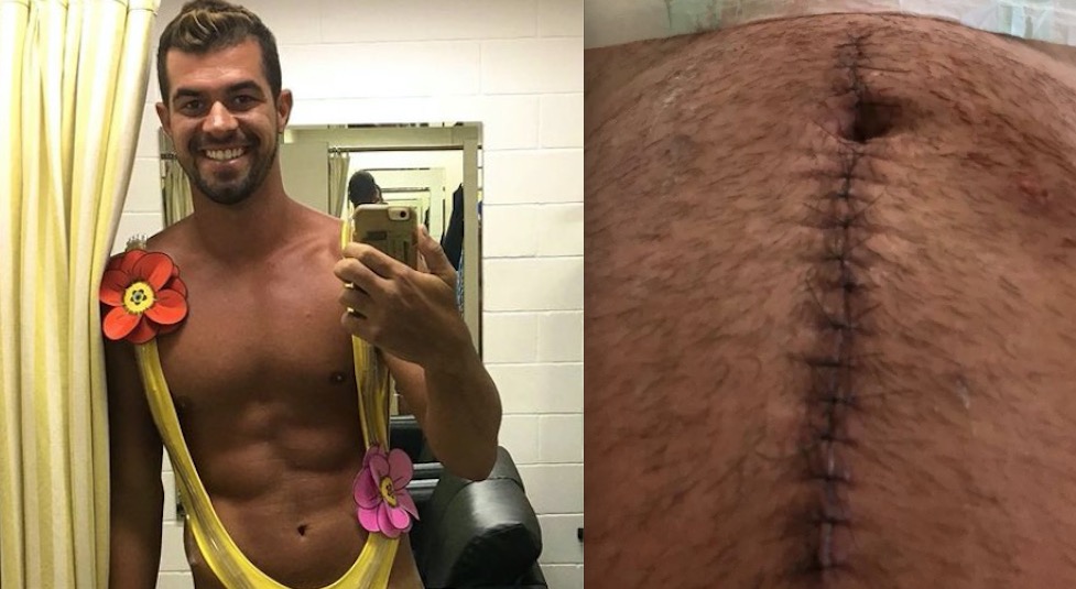 Borat, de 'Amor & Sexo', mostra imagem chocante de cicatriz no abdômen 