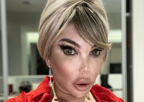 Ex-Ken Humano, Jéssica Alves, opera nariz pela segunda vez 