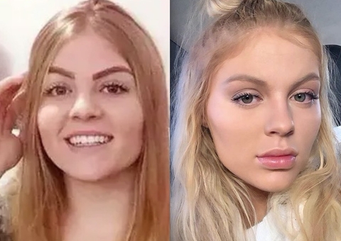 Luísa Sonza revela que nunca fez harmonização e explica mudança no rosto