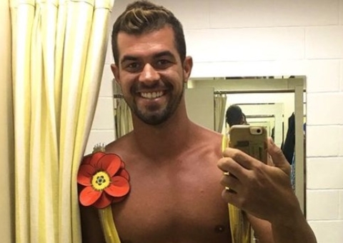 Borat, de 'Amor & Sexo', mostra imagem chocante de cicatriz no abdômen 