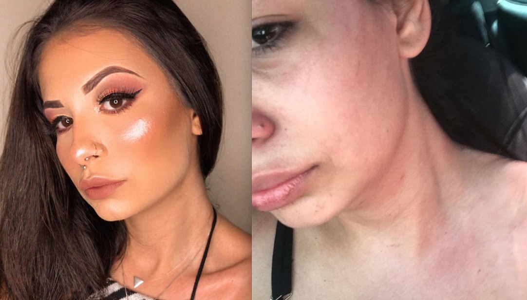 Ex de Darlan Cunha relata agressão que sofreu do ator: 'bateu até desmaiar'