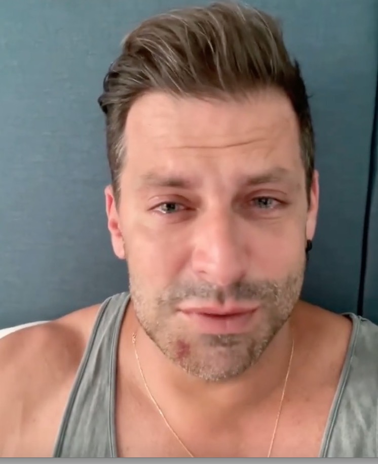 Henri Castelli chora e mostra mandíbula quebrada: 'covardemente agredido'