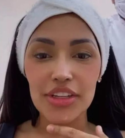 Ex-BBB Flay passa por novo procedimento estético em quatro meses