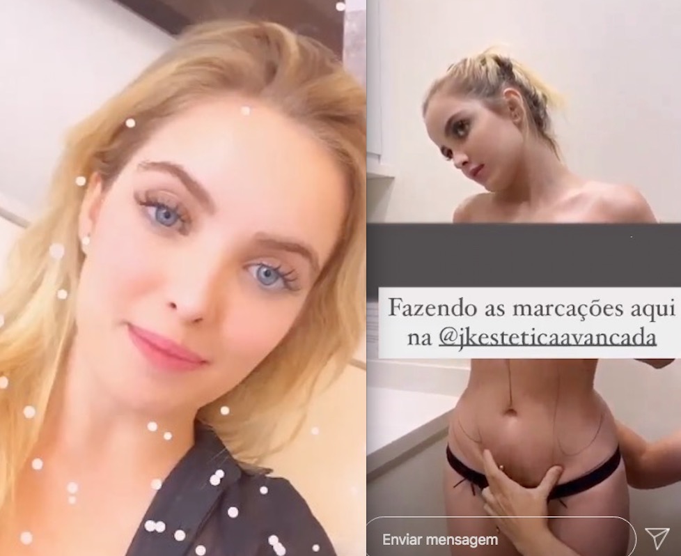 Aos 18, Giovanna Chaves anuncia lipoaspiração e é criticada por internautas