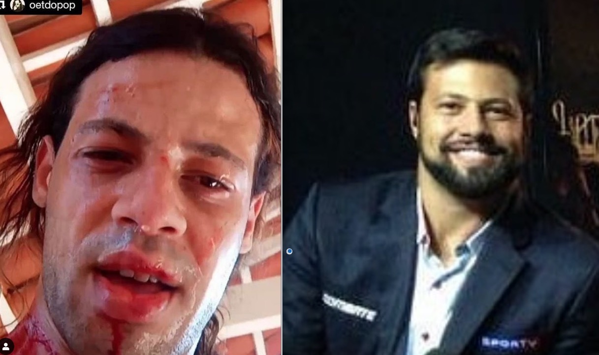 Irmão de narrador de UFC do SporTV é espancado por 7 homens, por ser gay 