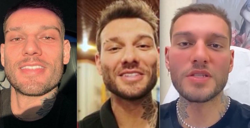 Lucas Lucco reverte harmonização facial criticada: 'ruim pra autoestima'