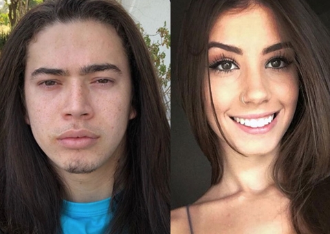 Namorada de Whindersson Nunes faz harmonização facial; veja o resultado