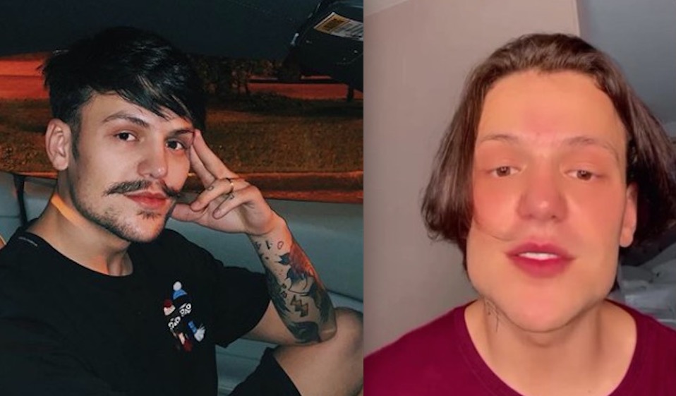 Web aponta harmonização facial em Saulo Pôncio: 'beiçola'