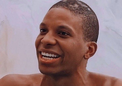 Alopecia: Entenda o que são as falhas no cabelo de Lucas do BBB21