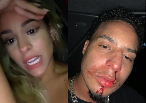 Ensanguentado, amigo de Ludmilla rebate influencer sobre agressão