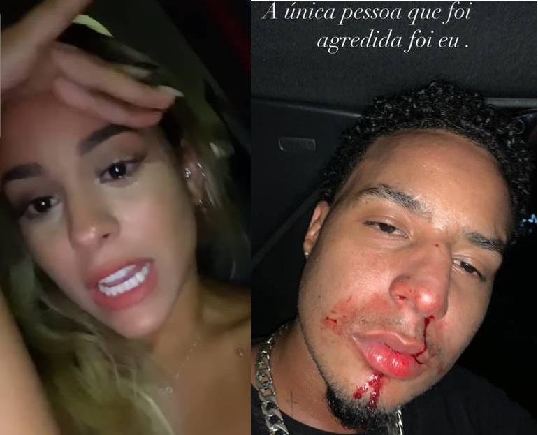 Ensanguentado, amigo de Ludmilla rebate influencer sobre agressão