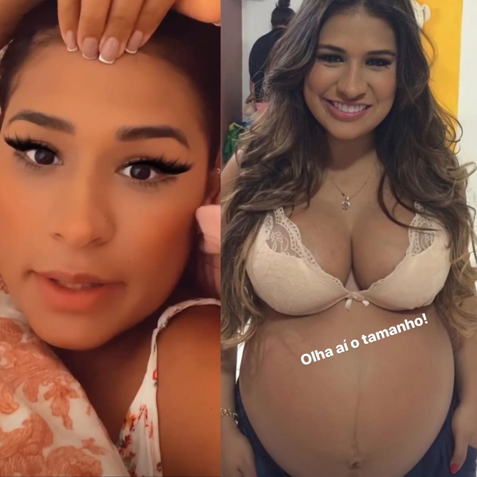Simone sobre tamanho da barriga na segunda gravidez: 'gêmeos'