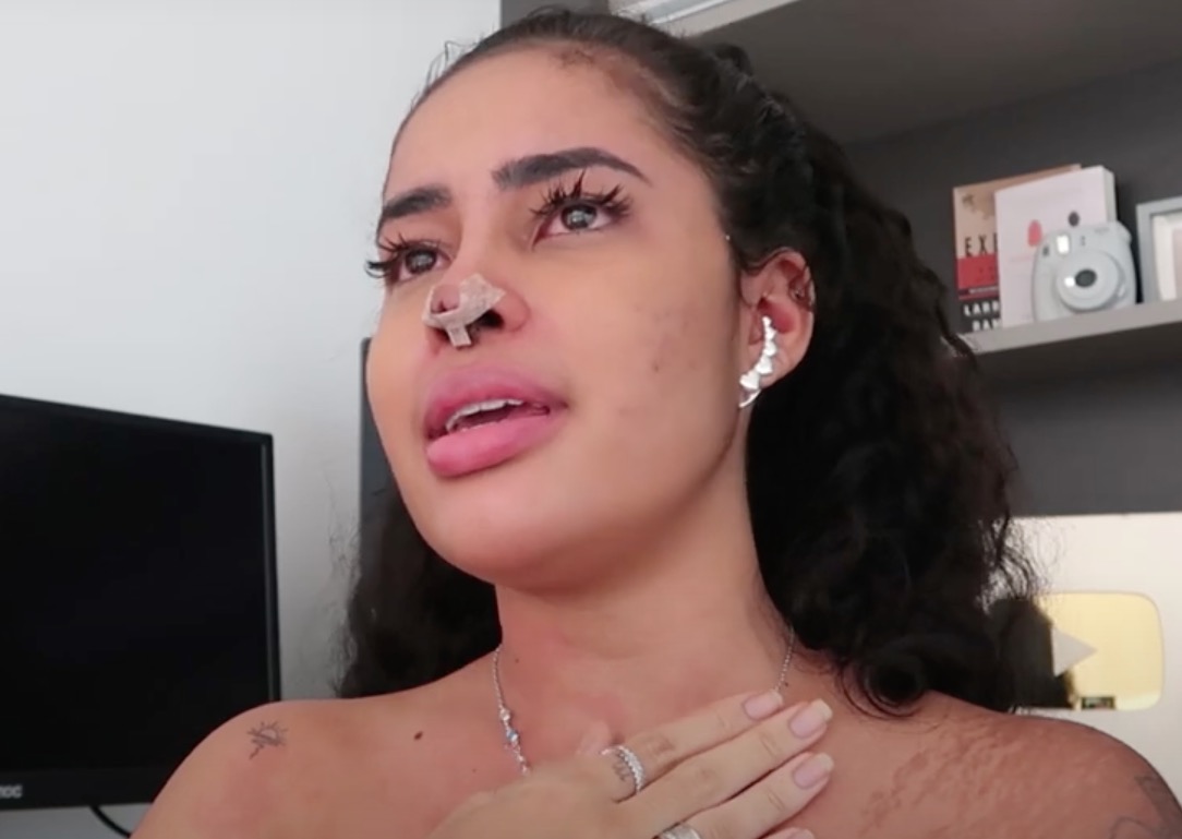 Sthefane Matos sobre complicações em rinoplastia: 'nariz abriu três vezes'