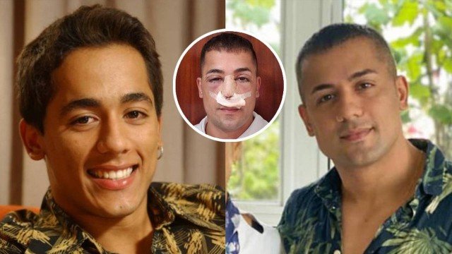 Tiago, da dupla com Hugo, surge irreconhecível após procedimentos estéticos