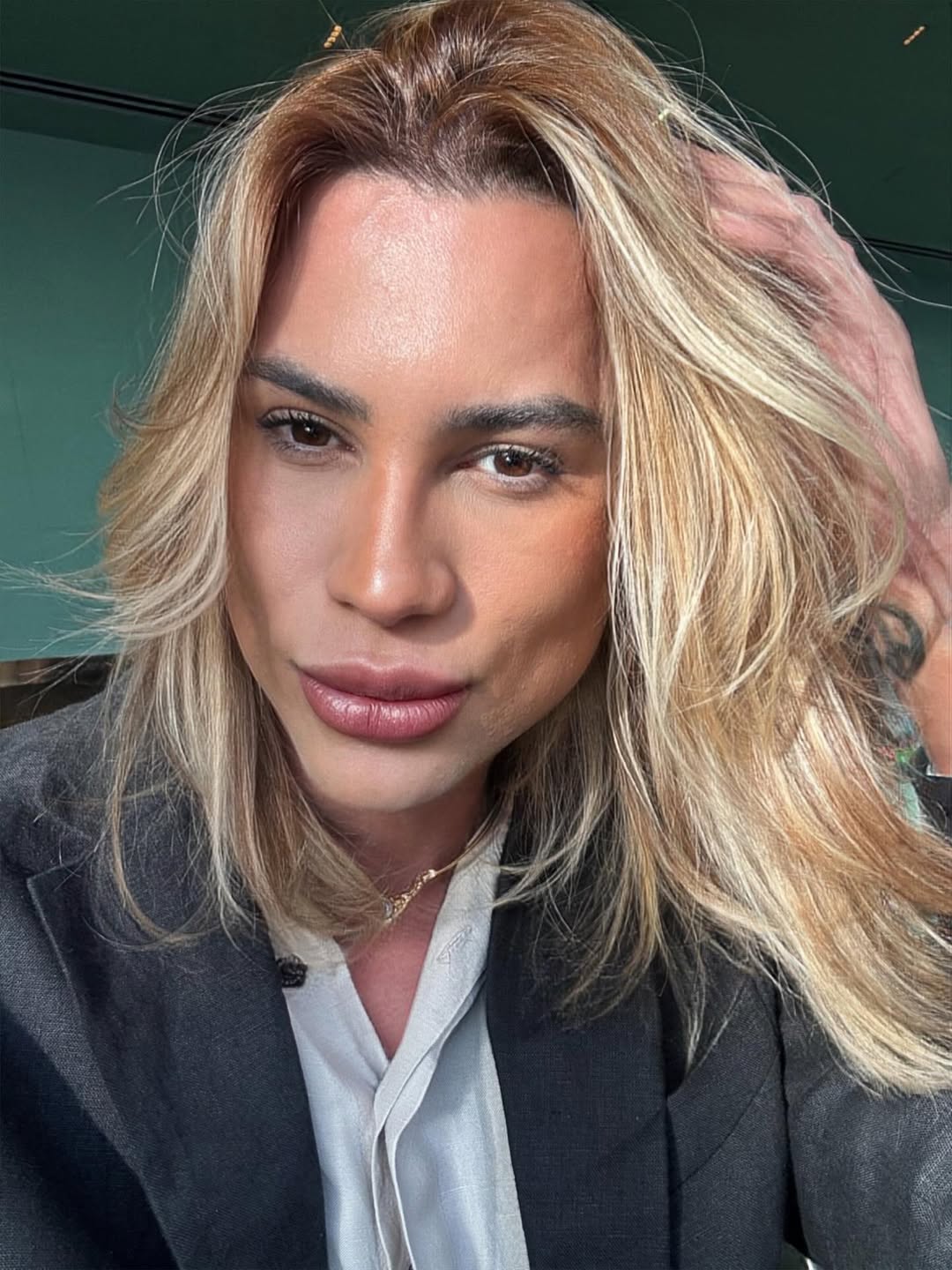 Dentista se pronuncia após morte de influenciador por procedimento estético