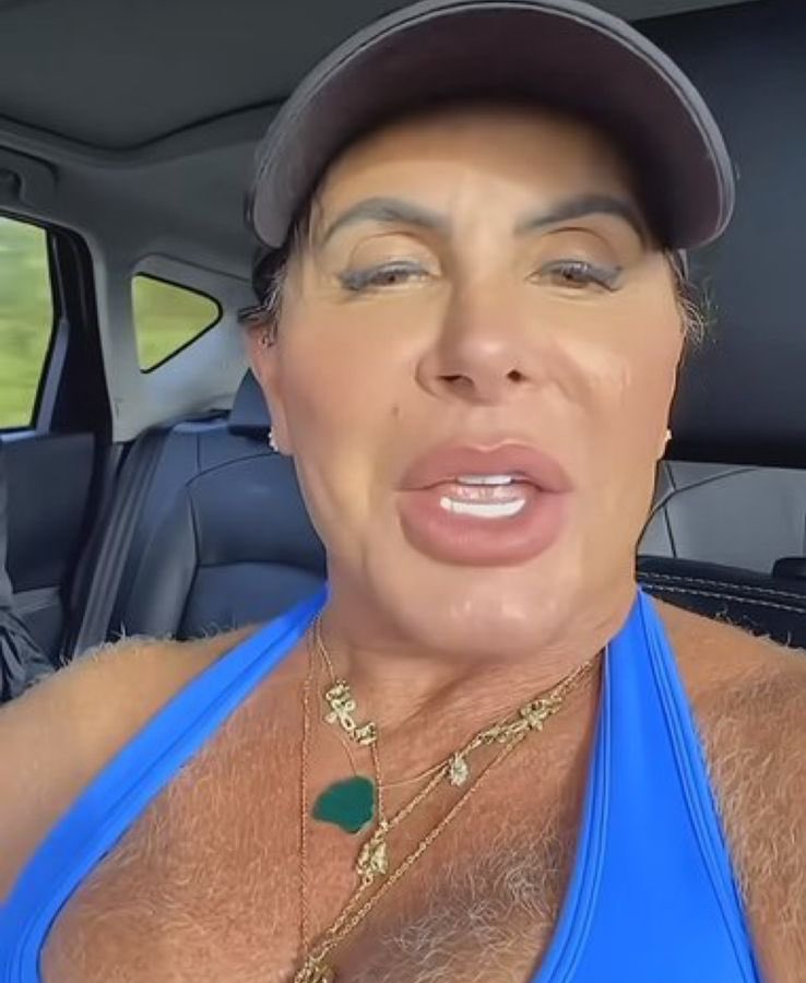 Gretchen volta a chocar seguidores com pelos nos seios e ombros