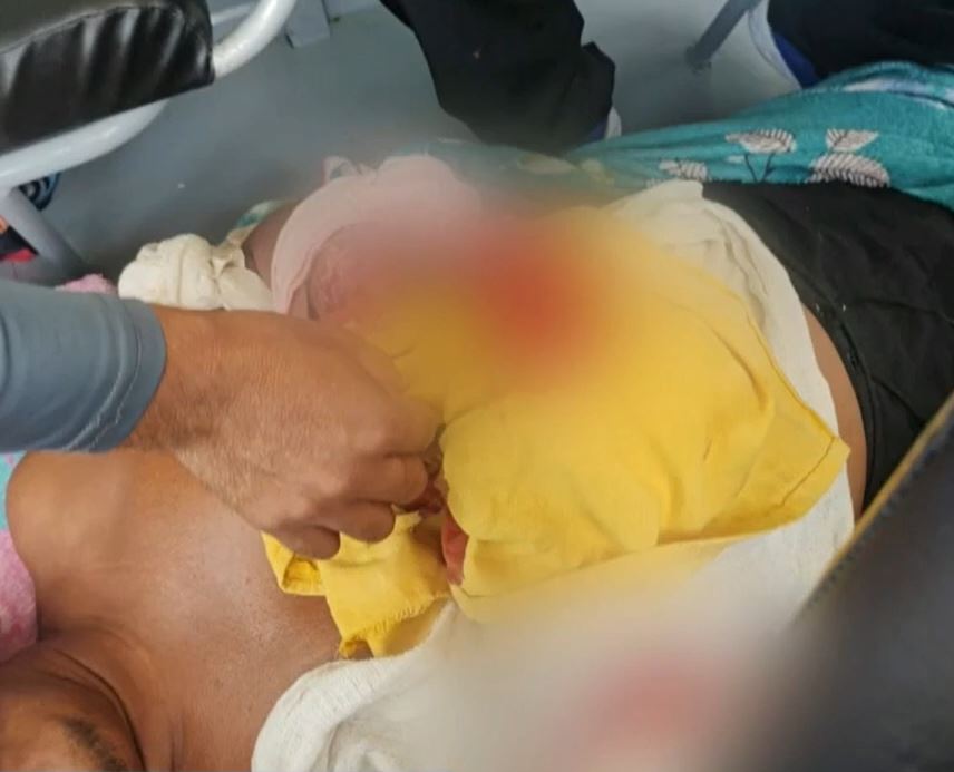 Pescador tem braço dilacerado ao ser atacado por jacaré no Amazonas