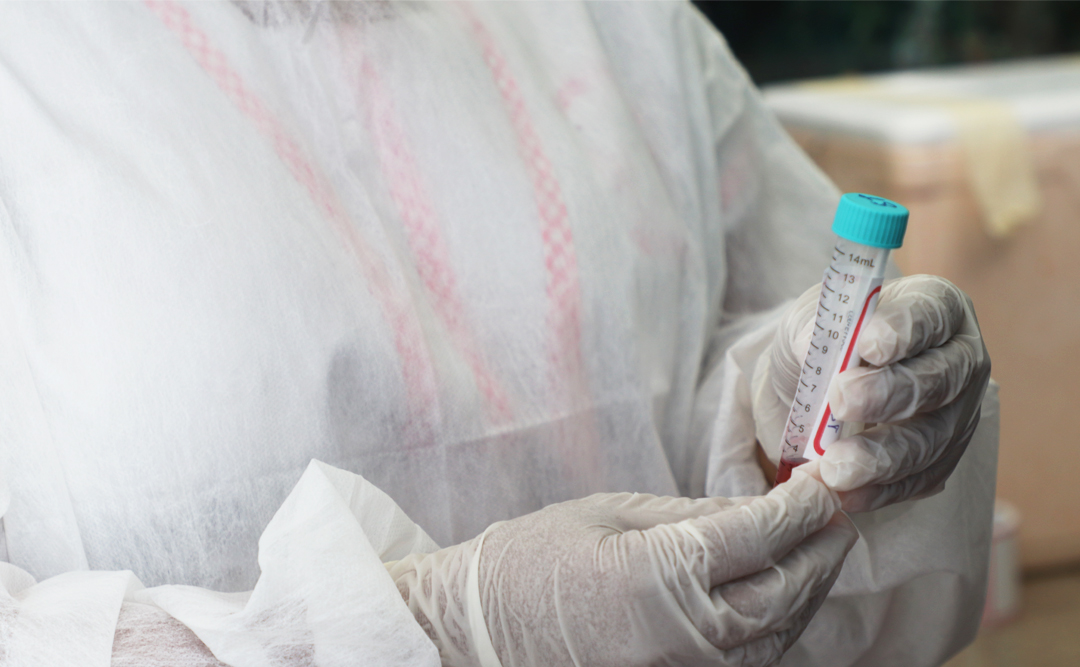 Alunos fraudam testes positivos de Covid-19 para faltarem escola