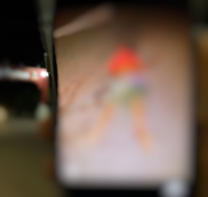 Idoso tem perna dilacerada e morre ao ser atropelado por carro na AM-010