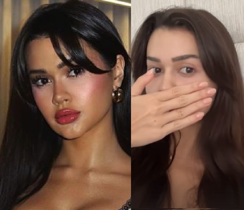 Franciny Ehlke retira preenchimento labial e mostra resultado