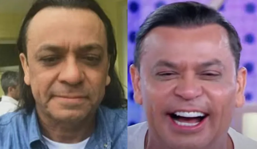 Frank Aguiar faz harmonização facial e corta cabelos; veja antes e depois
