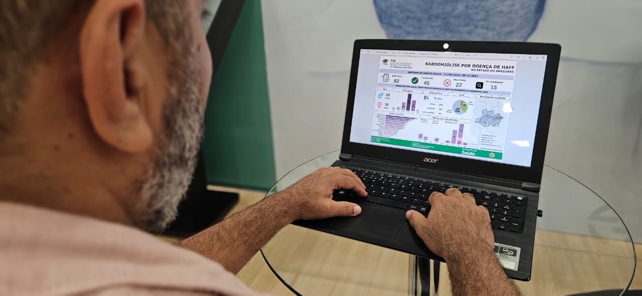 Amazonas registra 45 casos de doença da urina preta