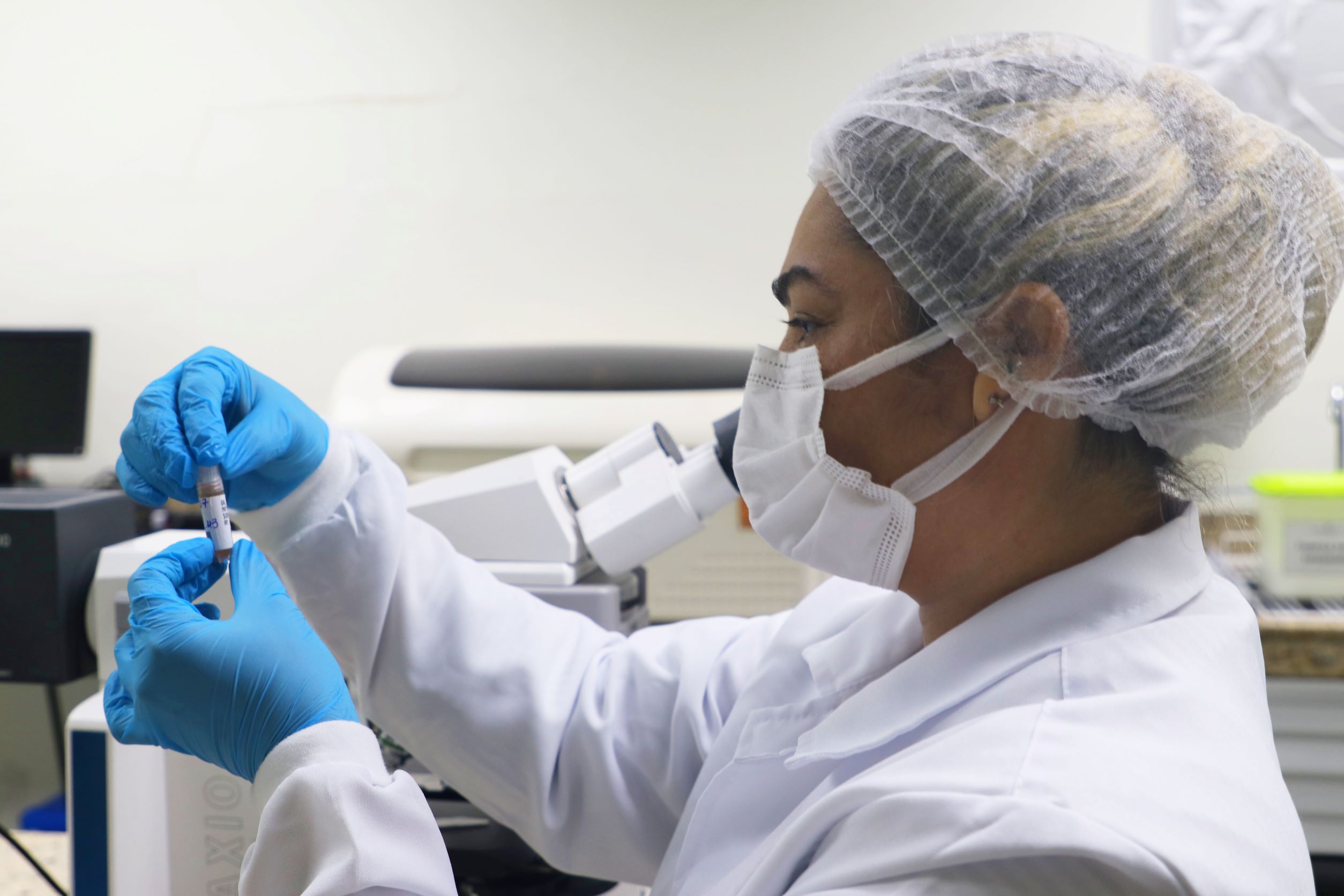 Amazonas registra 27 casos confirmados de Mpox, aponta boletim da FVS