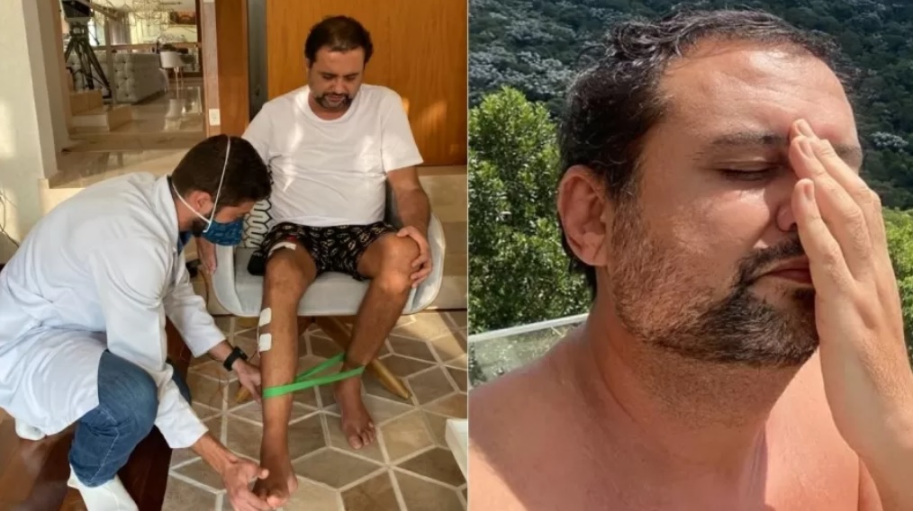 Com sequela da covid, Geraldo Luis perde movimento da perna direita 