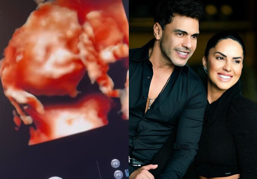  Graciele Lacerda mostra ultrassom 3D com rostinho do filho: 'boca do Zezé'