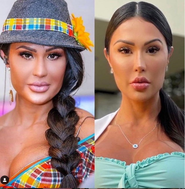 Gracyanne Barbosa impressiona com transformação no rosto: ‘afinamento’