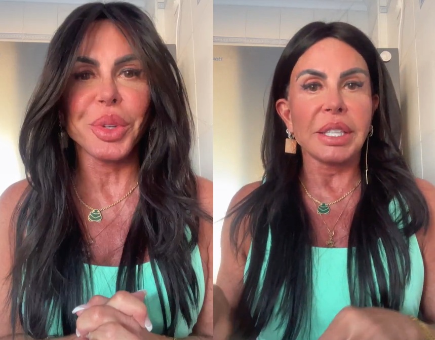 Gretchen mostra resultado de nova harmonização; veja