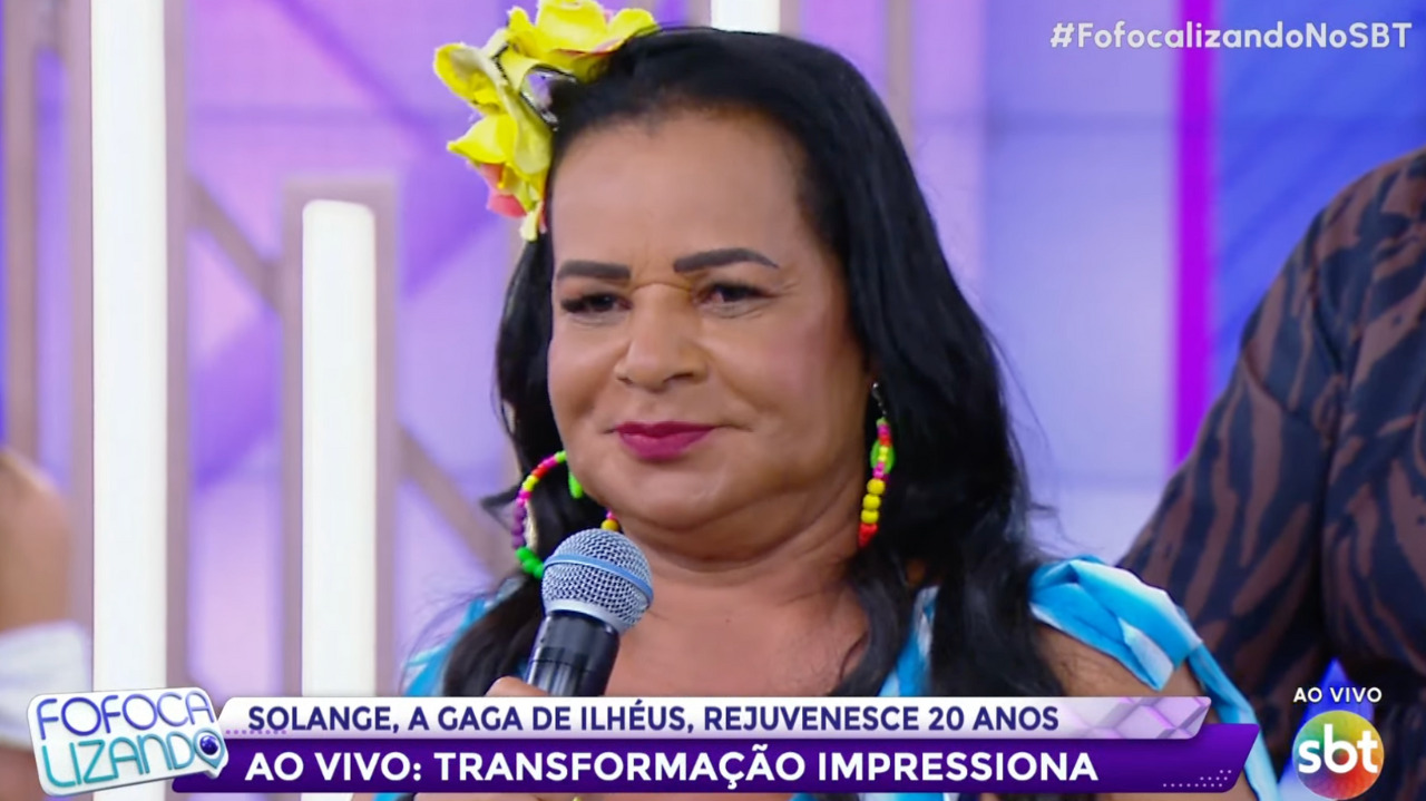 Lembra dela? Gaga de Ilhéus faz harmonização facial e resultado surpreende 
