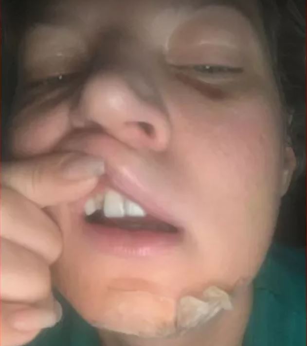 Polícia conclui investigação e diz que Joice Hasselmann não foi espancada