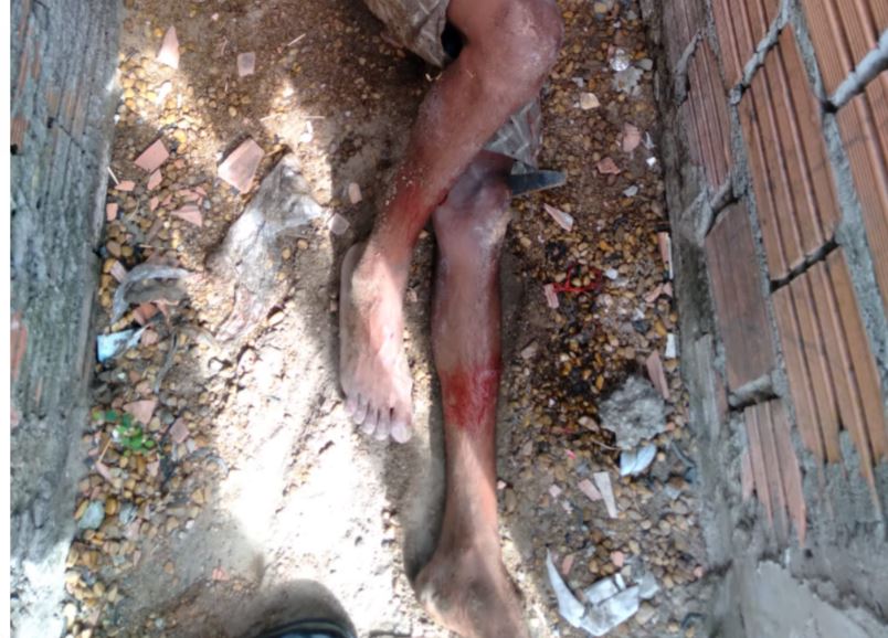 Homem é atacado a terçadadas e deixado para morrer em beco de Manaus