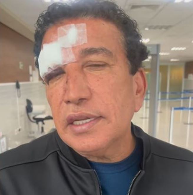 Magno Malta sofre acidente em banheiro de hotel e vai parar no hospital 