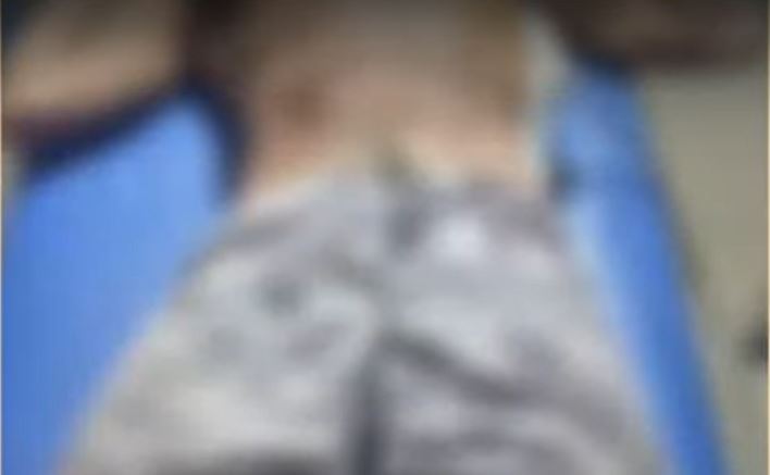 Adolescente é baleado na frente de casa no Amazonas