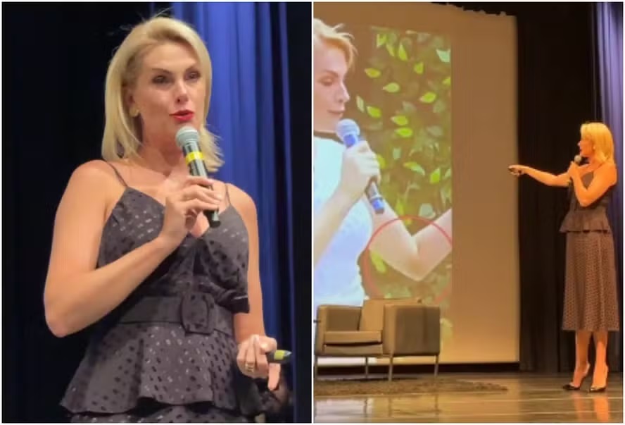 Ana Hickmann chora ao mostrar hematomas de violência doméstica; fotos
